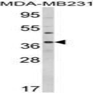 anti-BCL2-Associated Athanogene (BAG1) (C-Term) antibody avatar