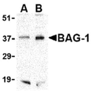 anti-BCL2-Associated Athanogene (BAG1) (C-Term) antibody avatar
