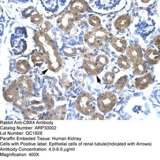anti-Chromobox Homolog 4 (CBX4) (N-Term) antibody avatar