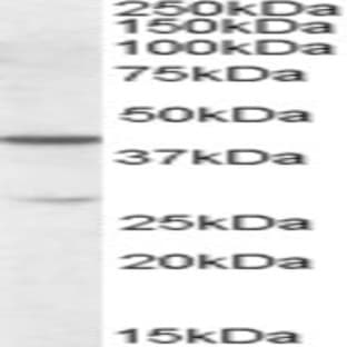 anti-Chromobox Homolog 8 (CBX8) (Internal Region) antibody avatar