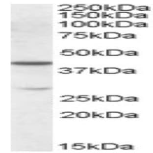 anti-Chromobox Homolog 8 (CBX8) (Internal Region) antibody avatar