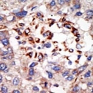anti-Chromobox Homolog 8 (CBX8) (C-Term) antibody avatar