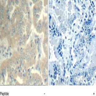 anti-PTK2 Protein tyrosine Kinase 2 (PTK2) (Tyr576), (Tyr577) antibody avatar