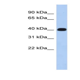 anti-Ermin, ERM-Like Protein (ERMN) (Middle Region) antibody avatar