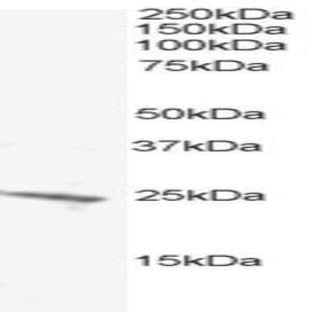anti-BCL2-Antagonist/killer 1 (BAK1) (N-Term) antibody avatar