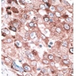 anti-BCL2-Antagonist/killer 1 (BAK1) (N-Term), (BH3 Domain) antibody avatar