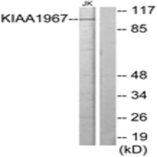 anti-Cell Cycle and Apoptosis Regulator 2 (CCAR2) (AA 431-480) antibody avatar