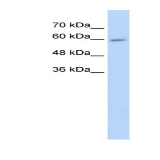 anti-Cytochrome P450, Family 4, Subfamily F, Polypeptide 11 (CYP4F11) (N-Term) antibody avatar