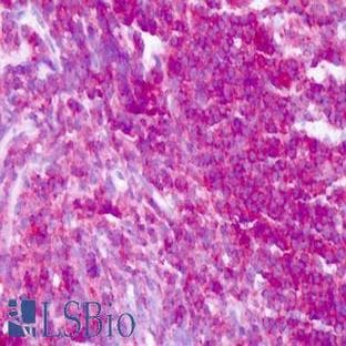anti-Protein tyrosine Phosphatase, Receptor Type, C (PTPRC) (Internal Region) antibody avatar