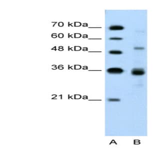 anti-CUGBP, Elav-Like Family Member 3 (CELF3) (N-Term) antibody avatar