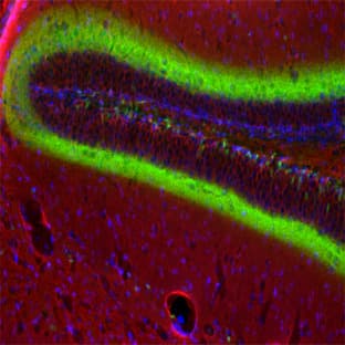 anti-Actin, beta (ACTB) (AA 2-16) antibody avatar