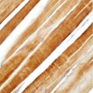 anti-Actin, alpha 1, Skeletal Muscle (ACTA1) (N-Term) antibody avatar