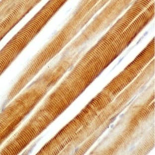 anti-Actin, alpha 1, Skeletal Muscle (ACTA1) (N-Term) antibody avatar