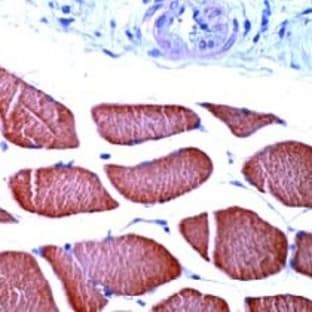 anti-Actin, alpha 1, Skeletal Muscle (ACTA1) (N-Term) antibody avatar