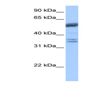 anti-Coilin (COIL) (C-Term) antibody avatar