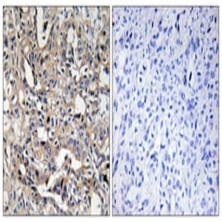 anti-BCL2-Associated X Protein (BAX) antibody avatar