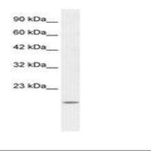 anti-BCL2-Associated X Protein (BAX) (N-Term) antibody avatar