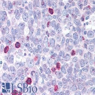 anti-BCL2-Associated X Protein (BAX) (N-Term) antibody avatar