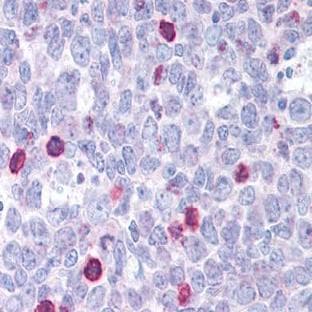 anti-BCL2-Associated X Protein (BAX) antibody avatar