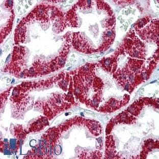 anti-BCL2-Associated X Protein (BAX) antibody avatar