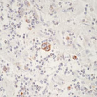 anti-BCL2-Associated X Protein (BAX) antibody avatar