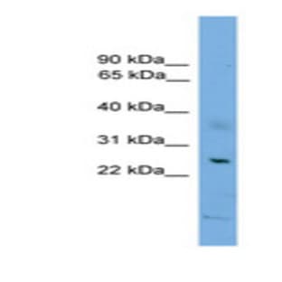 anti-BCL2-Associated X Protein (BAX) (N-Term) antibody avatar