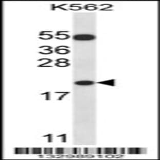 anti-BCL2-Associated X Protein (BAX) (N-Term), (AA 28-56) antibody avatar