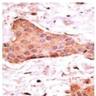 anti-BCL2-Associated X Protein (BAX) (N-Term) antibody avatar