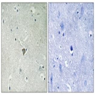 anti-BCL2-Associated X Protein (BAX) antibody avatar