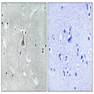 anti-BCL2-Associated X Protein (BAX) (pSer184) antibody avatar