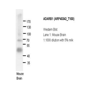 anti-Adenosine Deaminase, RNA-Specific, B1 (ADARB1) (N-Term) antibody avatar