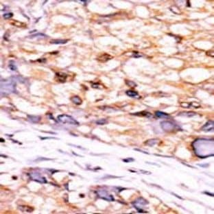 anti-CTD (Carboxy-terminal Domain, RNA Polymerase II, Polypeptide A) Small Phosphatase 1 (CTDSP1) (C-Term), (AA 1-250), (N-Term) antibody avatar