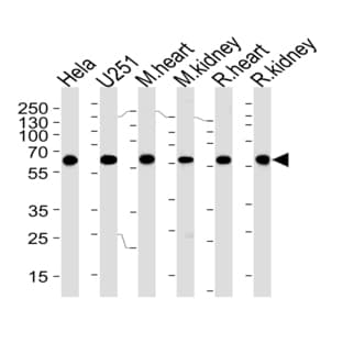 anti-Bardet-Biedl Syndrome 4 (BBS4) (Center) antibody
