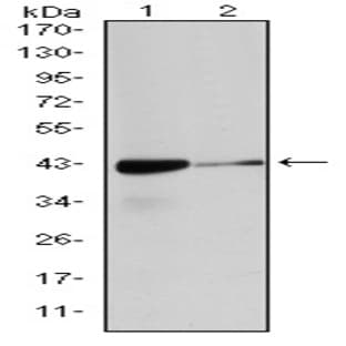 anti-Actin, alpha 2, Smooth Muscle, Aorta (ACTA2) antibody avatar
