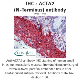 anti-Actin, alpha 2, Smooth Muscle, Aorta (ACTA2) (N-Term) antibody avatar