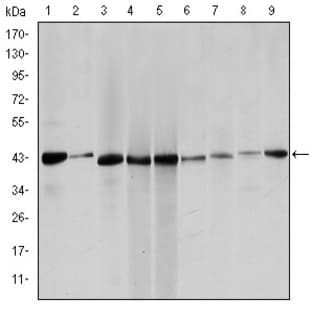 anti-Actin, alpha 2, Smooth Muscle, Aorta (ACTA2) antibody avatar