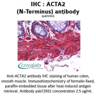anti-Actin, alpha 2, Smooth Muscle, Aorta (ACTA2) (N-Term) antibody avatar