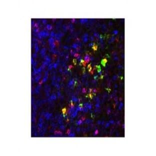 anti-Chemokine (C-C Motif) Receptor 9 (CCR9) (N-Term), (AA 3-22) antibody avatar