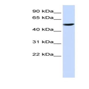 anti-Cytochrome B-561 (CYB561) (Middle Region) antibody avatar