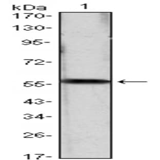 anti-Cyclin D1 (CCND1) antibody avatar