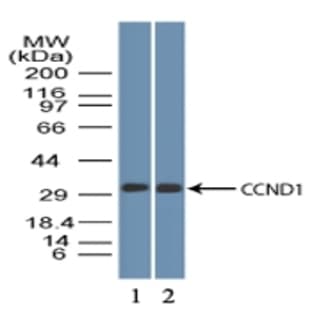 anti-Cyclin D1 (CCND1) (AA 250-300) antibody avatar