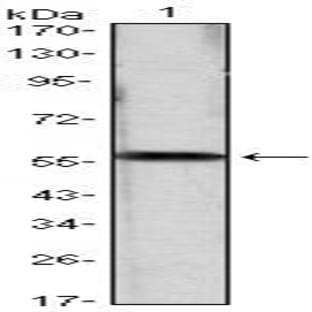 anti-Cyclin D1 (CCND1) antibody avatar