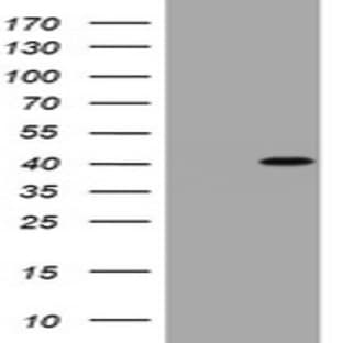 anti-Cyclin D1 (CCND1) antibody avatar