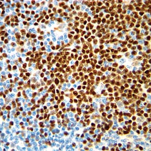 anti-Cyclin D1 (CCND1) (C-Term) antibody avatar