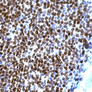 anti-Cyclin D1 (CCND1) (C-Term) antibody avatar