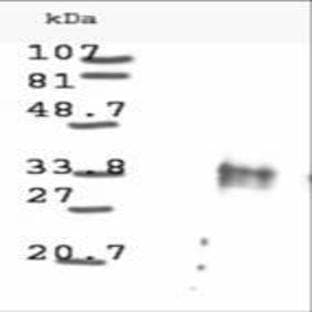 anti-Cyclin D1 (CCND1) antibody avatar
