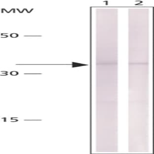anti-Cyclin D1 (CCND1) antibody avatar