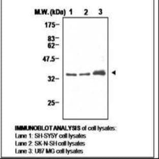 anti-Cyclin D1 (CCND1) antibody avatar