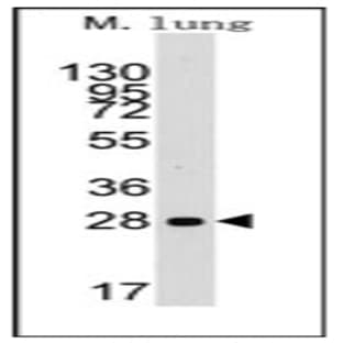 anti-Cyclin D1 (CCND1) (N-Term) antibody avatar