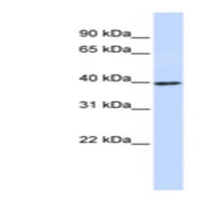 anti-Cyclin D1 (CCND1) (Internal Region) antibody avatar